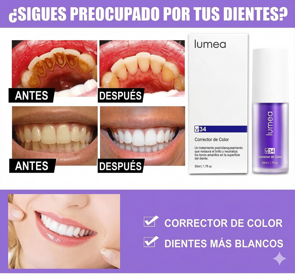 Lumea blanqueador dental